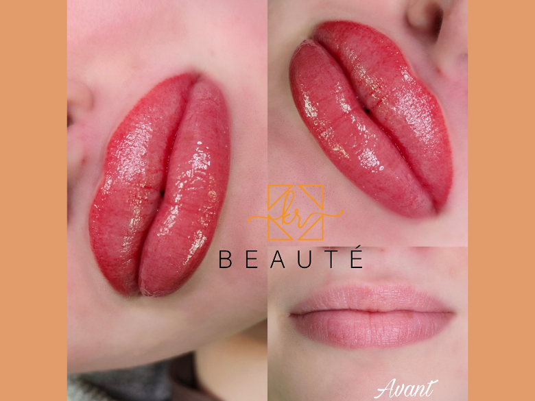 Séance de Lip Blush, pour des lèvres belles et naturelles