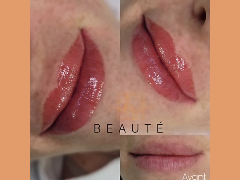 Photo – KR Beauté – Lip Blush – 2024 – 1